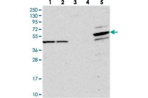 Western blot analysis of Lane 1: RT-4, Lane 2: U-251 MG, Lane 3: Human Plasma, Lane 4: Liver, Lane 5: Tonsil with PDE12 polyclonal antibody  at 1:250-1:500 dilution. (PDE12 antibody)
