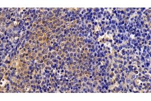 Immunohistochemistry (IHC) image for anti-Signal Transducer and Activator of Transcription 1, 91kDa (STAT1) (AA 343-602) antibody (ABIN7443806)