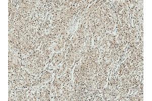 Immunohistochemistry analysis using Rabbit Anti-ATG10 Polyclonal Antibody (ABIN5065886). (ATG7 antibody  (N-Term) (Atto 390))