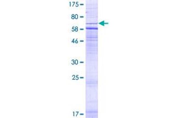 CRHR2 Protein (AA 1-411) (GST tag)
