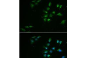 Immunofluorescence analysis of MCF7 cells using PPOX Polyclonal Antibody (PPOX antibody)