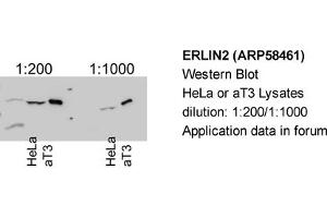 Western Blotting (WB) image for anti-ER Lipid Raft Associated 2 (ERLIN2) (Middle Region) antibody (ABIN406694) (ERLIN2 antibody  (Middle Region))