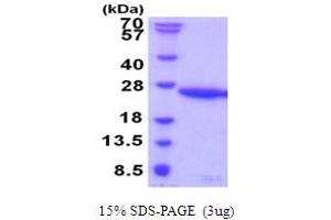 SDS-PAGE (SDS) image for Ubiquitin-Conjugating Enzyme E2G 1 (Ube2g1) (AA 1-170) protein (His tag) (ABIN5853980) (UBE2G1 Protein (AA 1-170) (His tag))