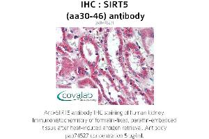 Image no. 1 for anti-Sirtuin 5 (SIRT5) (AA 30-46) antibody (ABIN1739285) (SIRT5 antibody  (AA 30-46))