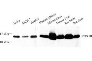 Western blot analysis of COX5B (ABIN7073665) at dilution of 1: 500 (COX5B antibody)
