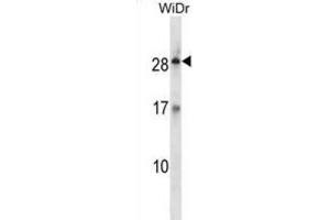 Western Blotting (WB) image for anti-Kallikrein-Related Peptidase 12 (KLK12) antibody (ABIN2998366)