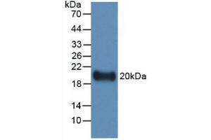 Detection of Recombinant IL19, Human using Monoclonal Antibody to Interleukin 19 (IL19) (IL-19 antibody  (AA 25-177))