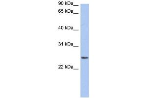 WB Suggested Anti-NRSN2 Antibody Titration:  0. (NRSN2 antibody  (Middle Region))