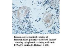 Image no. 1 for anti-P53-Regulated Apoptosis-Inducing Protein 1 (TP53AIP1) (N-Term) antibody (ABIN791019) (TP53AIP1 antibody  (N-Term))