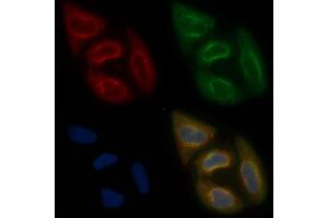 AWAT2 Mouse Monoclonal Antibody staining Hela cells by IF/ICC. (AWAT2 antibody  (Internal Region))