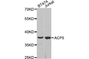 Western blot analysis of extracts of various cell lines, using ACP5 antibody. (ACP5 antibody  (AA 76-325))