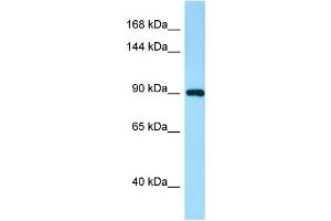 Western Blotting (WB) image for anti-IWS1 Homolog (IWS1) (N-Term) antibody (ABIN2790110) (IWS1 antibody  (N-Term))