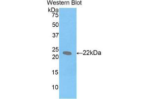 Western Blotting (WB) image for anti-Leukemia Inhibitory Factor (LIF) (AA 25-203) antibody (ABIN1859654)
