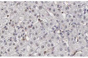 ABIN6266882 at 1/100 staining human liver tissue sections by IHC-P. (DNAJB1 antibody  (C-Term))