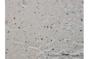Immunoperoxidase of monoclonal antibody to SALL2 on formalin-fixed paraffin-embedded human heart. (SALL2 antibody  (AA 1-198))