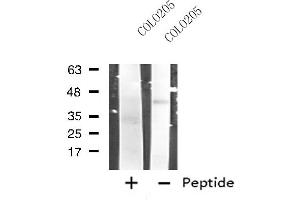 Western blot analysis of extracts from COLO205 cells, using RRM2B antibody. (RRM2B antibody  (N-Term))