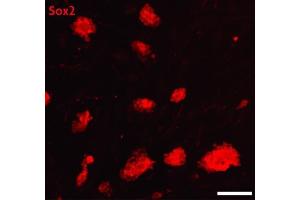 Sox2 antibody (pAb) tested by Immunofluorescence. (SOX2 antibody  (C-Term))