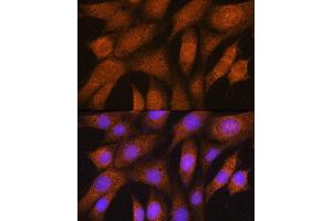 Immunofluorescence analysis of NIH/3T3 cells using GSTT2B Rabbit pAb (ABIN7267450) at dilution of 1:100. (GSTT2B antibody  (AA 115-244))