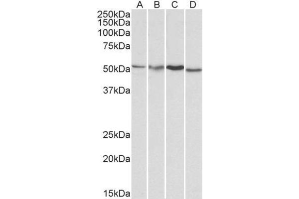 AKT3 antibody  (AA 119-133)