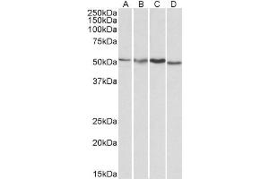 ABIN185314 (1µg/ml) staining of HepG2 (A), Jurkat (B), Mouse Brain (C) and Rat Brain (D) lysates (35µg protein in RIPA buffer). (AKT3 antibody  (AA 119-133))