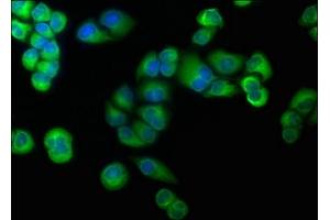 Immunofluorescence staining of Hela cells with ABIN7139839 at 1:166, counter-stained with DAPI. (Foxo6 antibody  (AA 211-218))