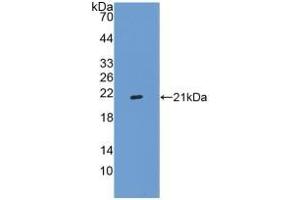 Detection of Recombinant ITGa2B, Human using Polyclonal Antibody to Integrin Alpha 2B (ITGa2B) (Integrin Alpha2b antibody  (AA 891-1039))