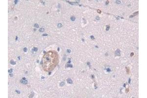 Detection of SPON2 in Human Cerebrum Tissue using Polyclonal Antibody to Spondin 2 (SPON2) (SPON2 antibody  (AA 119-331))