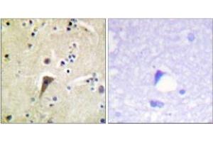 Immunohistochemistry analysis of paraffin-embedded human brain, using FAK (Phospho-Tyr397) Antibody. (FAK antibody  (pTyr397))