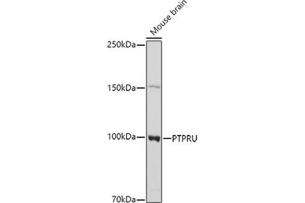 PTPRU Antikörper  (AA 1184-1433)