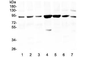 Western blot testing of Gelsolin antibody and Lane 1: HeLa