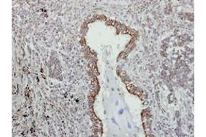 Image no. 1 for anti-VAMP (Vesicle-Associated Membrane Protein)-Associated Protein A, 33kDa (VAPA) (AA 79-92) antibody (ABIN467553) (VAPA antibody  (AA 79-92))