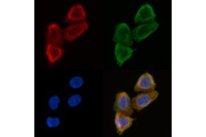 ABIN6258699 and ABIN6275026 staining Hela cells(30 min of UV treatment) by IF/ICC. (BEND4 antibody  (Internal Region))