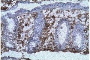 Labelling on frozen section (acetone fixed) of human colic mucosa with B-B20 diluted at 1:100 (background coloration by hematoxylin). (CD40 antibody)