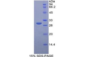SDS-PAGE analysis of Rat Insulin Like Growth Factor 2 Receptor (IGF2R) Protein. (IGF2R Protein)