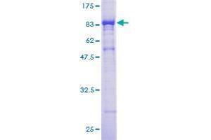 CORO1B Protein (AA 1-489) (GST tag)
