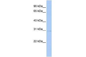 WB Suggested Anti-STK16 Antibody Titration:  0. (STK16 antibody  (Middle Region))