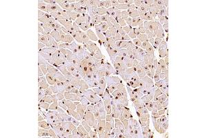Immunohistochemistry (Paraffin-embedded Sections) (IHC (p)) image for anti-RB-Associated KRAB Zinc Finger (RBAK) antibody (ABIN7075383)