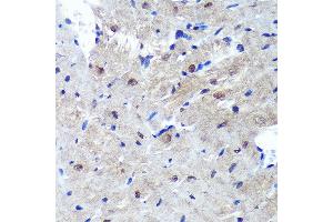 Immunohistochemistry of paraffin-embedded Mouse heart using PSME4 Rabbit pAb  at dilution of 1:100 (40x lens). (PSME4 antibody  (AA 1634-1843))