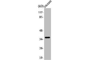 Western Blot analysis of COLO205 cells using Apaf-1-ALT Polyclonal Antibody (APAF1 antibody  (C-Term))