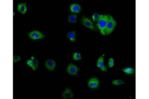 Immunofluorescence staining of HepG2 cells with ABIN7160065 at 1:166, counter-stained with DAPI. (MAP4K2 antibody  (AA 386-469))
