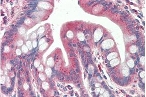 ABIN768661 (5µg/ml) staining of paraffin embedded Human Small Intestine. (TXNDC11 antibody  (AA 113-126))