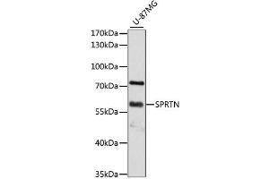 Western blot analysis of extracts of U-87MG cells, using SPRTN antibody (ABIN4905286) at 1:3000 dilution. (Spartan antibody)