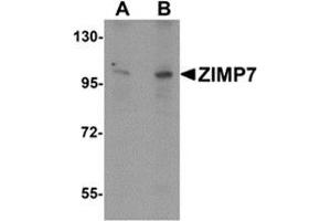 Western blot analysis of ZIMP7 in A20 cell lysate with ZIMP7 antibody at (A) 0. (ZMIZ2 antibody  (Center))