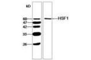 Image no. 1 for anti-Heat Shock Factor Protein 1 (HSF1) antibody (ABIN791450) (HSF1 antibody)
