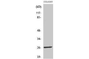 Western Blotting (WB) image for anti-Leucine Zipper, Down-Regulated in Cancer 1-Like (LDOC1L) (Internal Region) antibody (ABIN3185374) (LDOC1L antibody  (Internal Region))