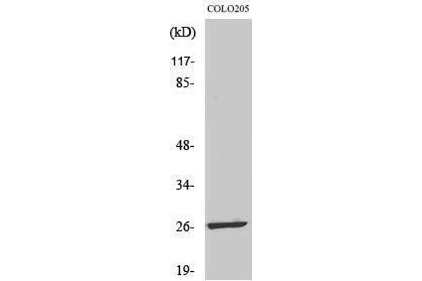LDOC1L 抗体  (Internal Region)