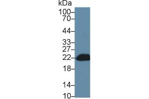 Western blot analysis of Mouse Blood Cells lysate, using Mouse Bid Antibody (1 µg/ml) and HRP-conjugated Goat Anti-Rabbit antibody ( (BID antibody  (AA 1-195))