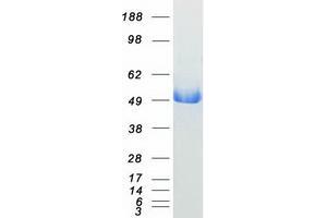 Validation with Western Blot (ASS1 Protein (Transcript Variant 2) (Myc-DYKDDDDK Tag))