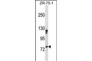 Western blot analysis in ZR-75-1 cell line lysates (35ug/lane). (KIF3A antibody  (C-Term))