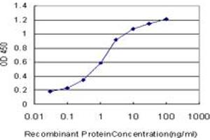 Detection limit for recombinant GST tagged PRL is approximately 0. (Prolactin antibody  (AA 29-227))